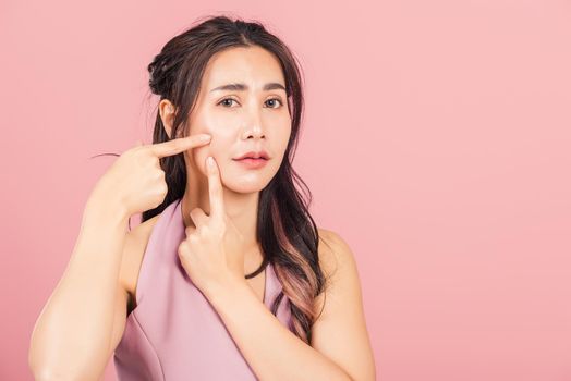 Portrait teenage Asian beautiful young woman having skin problems squeezing pimples on her face, studio shot on pink background, with copy space, Thai female acne, beauty care concept