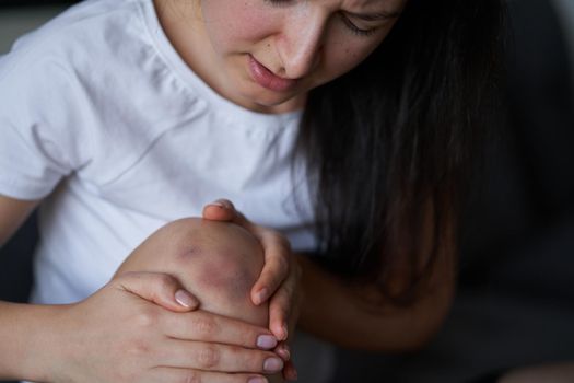 Close-up of a person massaging an injured knee joint. Bruise on the knee. Leg pain.