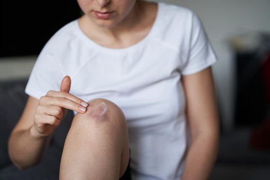 Close up of a person rubbing cream for healing injured knee joint. Bruise on the knee. Leg pain.