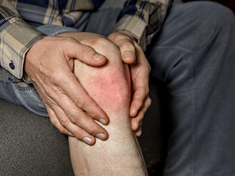 Elderly man holds his hands sore knee.