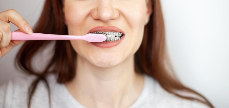 A girl with braces on her white teeth is brushing her teeth with a toothbrush. Straightening and dental hygiene. Dental care.