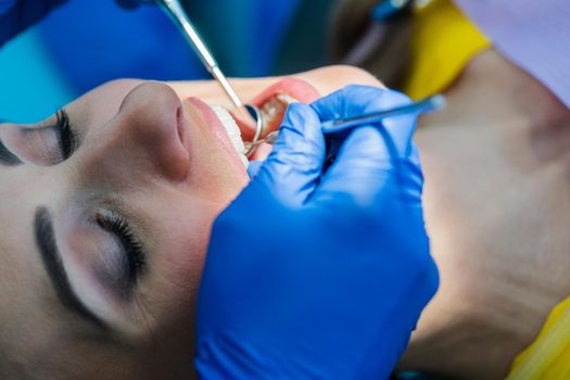 Beautiful woman at the dentist in prophylaxis session being looked after