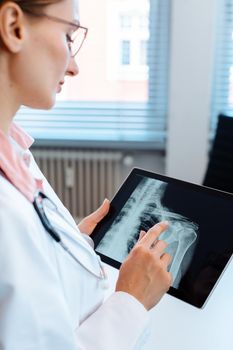 Doctor looking at x-ray picture of a shoulder on her modern tablet computer