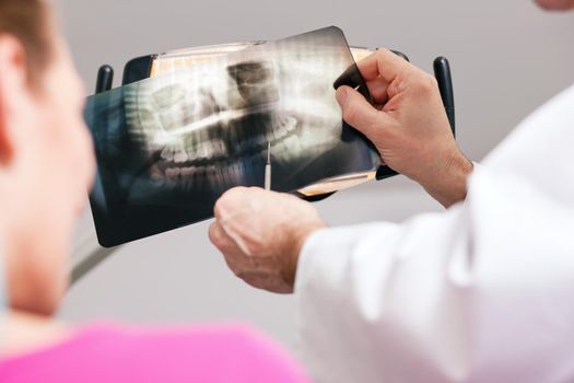 Dentist (only hands to be seen) explaining the details of a x-ray picture to his patient, focus on the picture