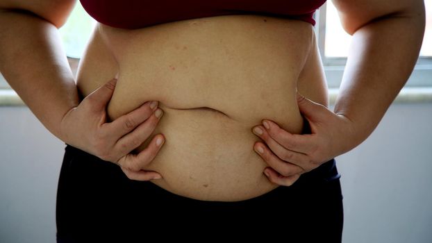 salvador, bahia / brazil - june 10, 2020: woman holds her belly where there is accumulation of abdominal cordura in the city of Salvador.