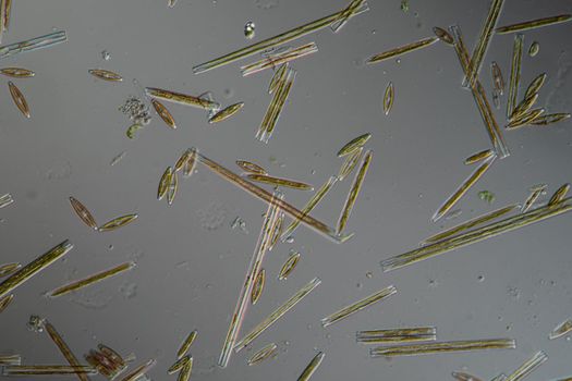 various diatoms from a river