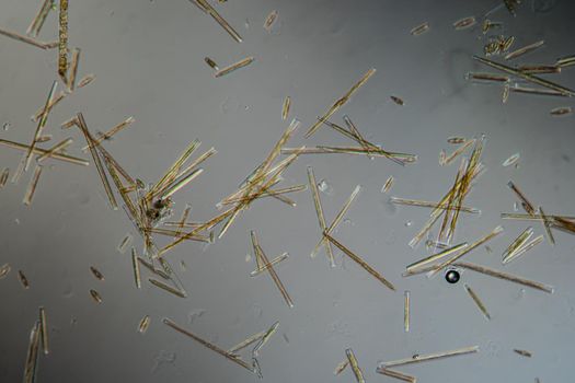 various diatoms from a river