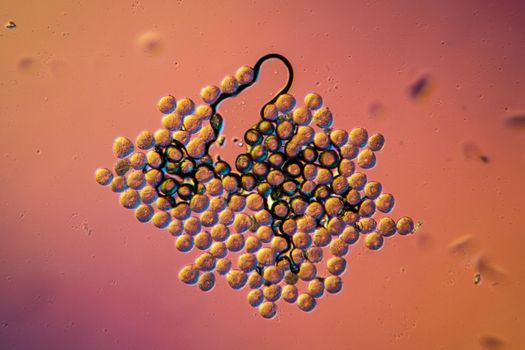 Apple pollen from a blossom in spring under the microscope