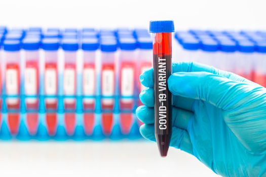 A medical Worker wearing gloves holding a plastic centrifuge tube with graduated marks with a Covid-19 variant virus blood sample.