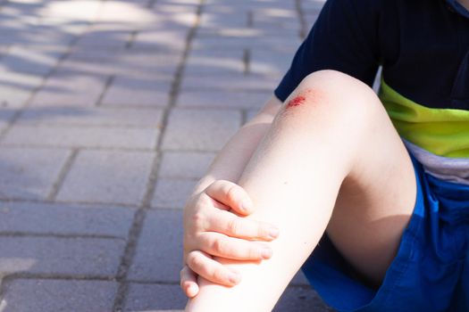The wound on the child's leg . Fell on the road. Broken knee. Health. Article about the fall of a child. Article about the treatment of wounds. Bad leg . The child fell and broke his knee . blood