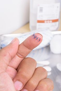 closeup wound with surgical stitch on the finger