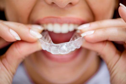 Close-up of beautiful young female patient try to put mobile orthodontic appliance for dental correction on her teeth. 