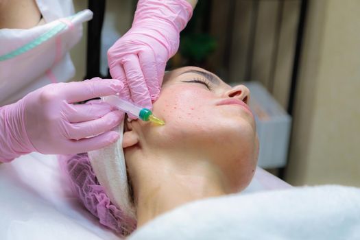 The doctor gives injections of blood plasma into the face of a young girl. Therapeutic procedure, plasmolifting