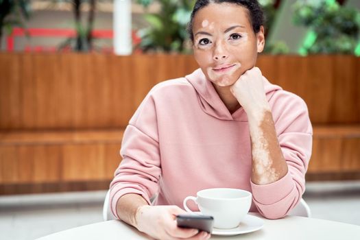 Black african american woman with vitiligo pigmentation skin problem indoor dressed pink hoodie sitting table using smartphone