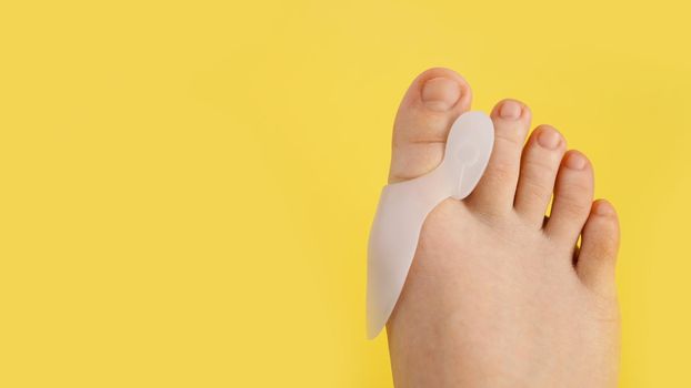 Silicone finger separator. Orthopedic thumb corrector. Legs on a bright yellow background.