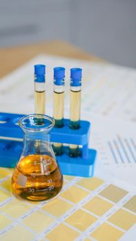 Flask and test tubes with urine on medical color schemes. The concept of laboratory analyzes, ph control. Vertical photo