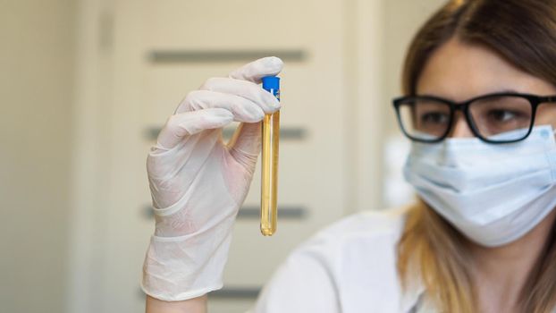 A woman holds a test tube with a urine test. Diagnostics and analysis concept. Health concept. Focus on the test tube