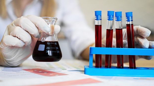 Hand of a scientific taking a blood sample tube from stand. Woman working with blood samples in laboratory, closeup