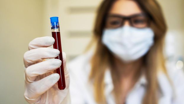 Female scientist holding test tube with blood sample. The concept of analyzes and diagnostics of viruses and diseases. Focus on the test tube