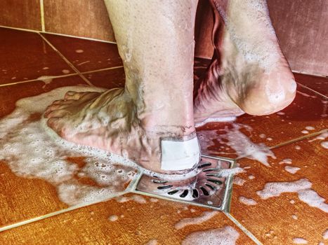 Naked woman leg with blister close Achilles heel, wound with bandage. Washin body in tiled shower corner.