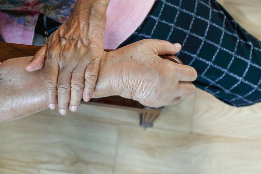 Elderly swollen hand or edema hand