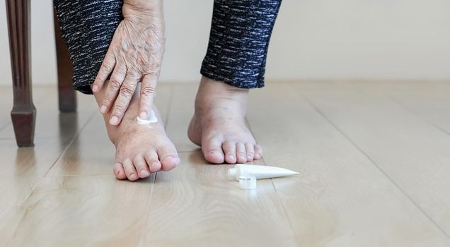 Elderly woman putting cream on swollen feet