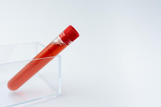 Presenting Medical Samples Laboratory Testing New Virus Medicine