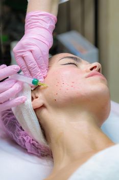 The doctor gives injections of blood plasma into the face of a young girl. Therapeutic procedure, plasmolifting