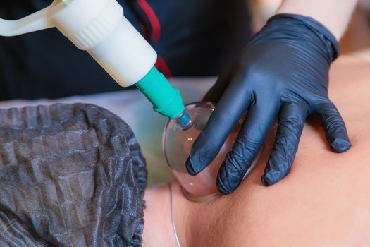 A hijama master performs a vacuum blood suction procedure for a young girl. Close-up