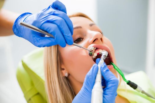 Young woman at dentist. Dentist is repairing her teeth.