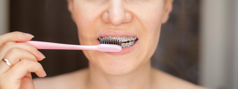 Girl with braces on her teeth brushing her teeth with a toothbrush, close-up. Dental and oral care. Braces for leveling teeth